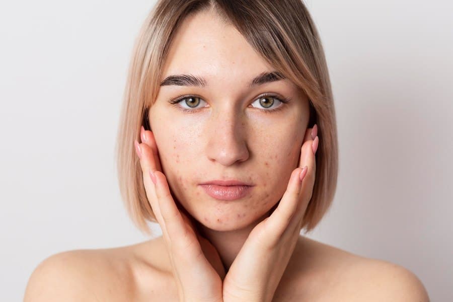 Young woman with clear skin framing her face with her hands