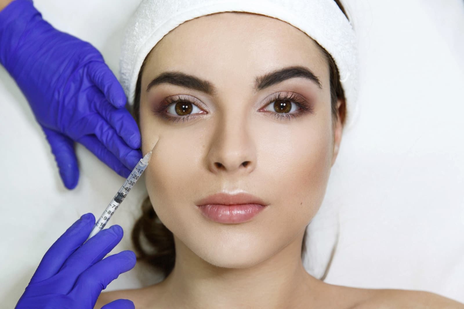 Filler injection along the cheek